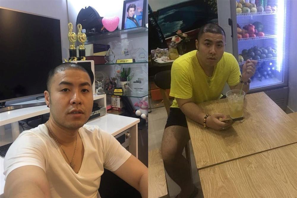 Cận cảnh quá trình phẫu thuật thẩm mỹ từ cấy tóc đến hút mỡ tốn đến 300 triệu để lấy lại vóc dáng của Akira Phan-1