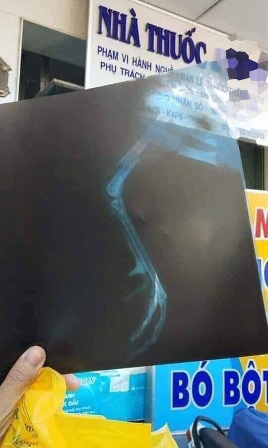 Chồng mang gà chọi đi chiếu chụp rồi bó bột khiến vợ điên tiết, bất ngờ hơn cả là lời khuyên của dân mạng-2