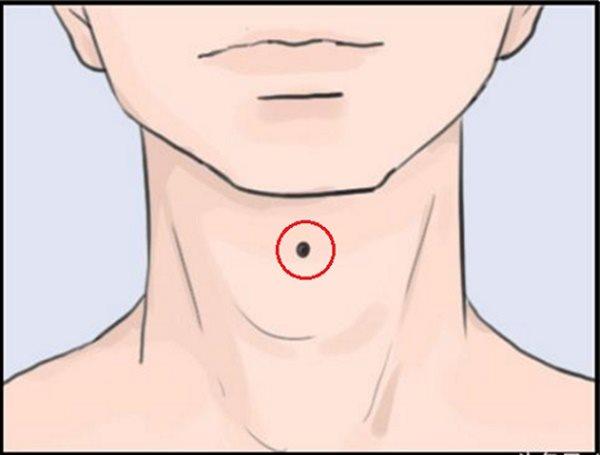 Vị trí nốt ruồi ở cổ báo hiệu điều gì về cuộc đời bạn: Sang giàu hay nghèo hèn?-2