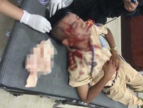 Clip: Nhóm người đi ô tô chống đối, lăng mạ CSGT khi bị kiểm tra-1