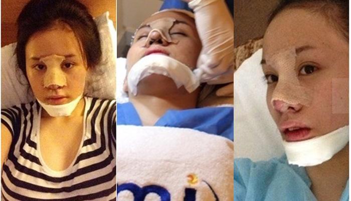 Nhìn chiếc mũi biến dạng như xuyên thủng vạn vật của bà Tưng, dân tình quả quyết: Thà xấu tự nhiên còn hơn đẹp nhân tạo-3