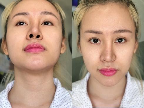 Bà Tưng tung clip khoe nhan sắc tái sinh sau khi ám ảnh người nhìn với chiếc mũi biến dạng-5