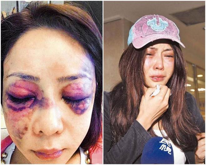 Người mẫu Đài Loan từng bị bạn trai đại gia đánh đập tàn nhẫn-2