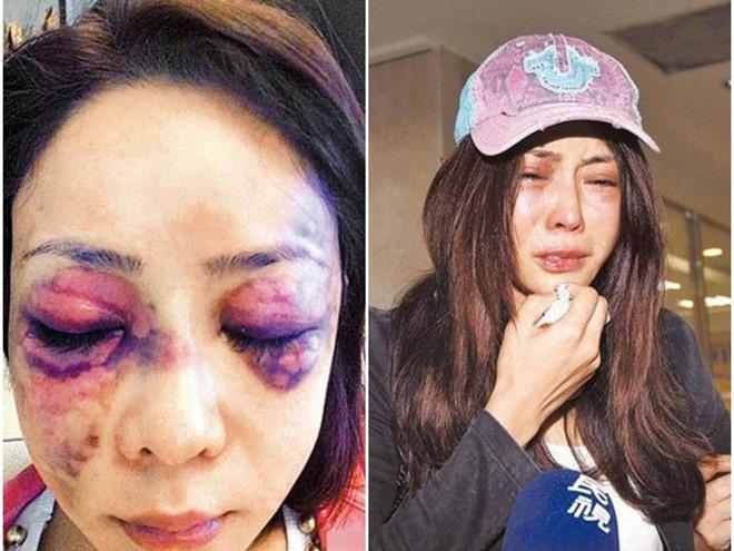 Bố người mẫu Nga 16 tuổi nghi con bị giết hại để lấy nội tạng-3