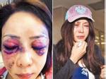 Người mẫu Đài Loan từng bị bạn trai đại gia đánh đập tàn nhẫn