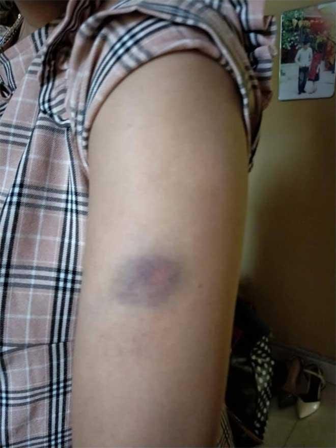 Chỉ vì mua đôi giày 135k, bà bầu 8 tháng bị mẹ chồng chì chiết nói theo trai, chồng đánh bầm dập động thai, tiểu ra máu-4