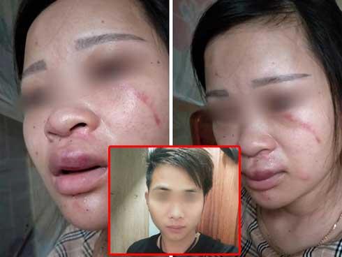 Chỉ vì mua đôi giày 135k, bà bầu 8 tháng bị mẹ chồng chì chiết nói theo trai, chồng đánh bầm dập động thai, tiểu ra máu