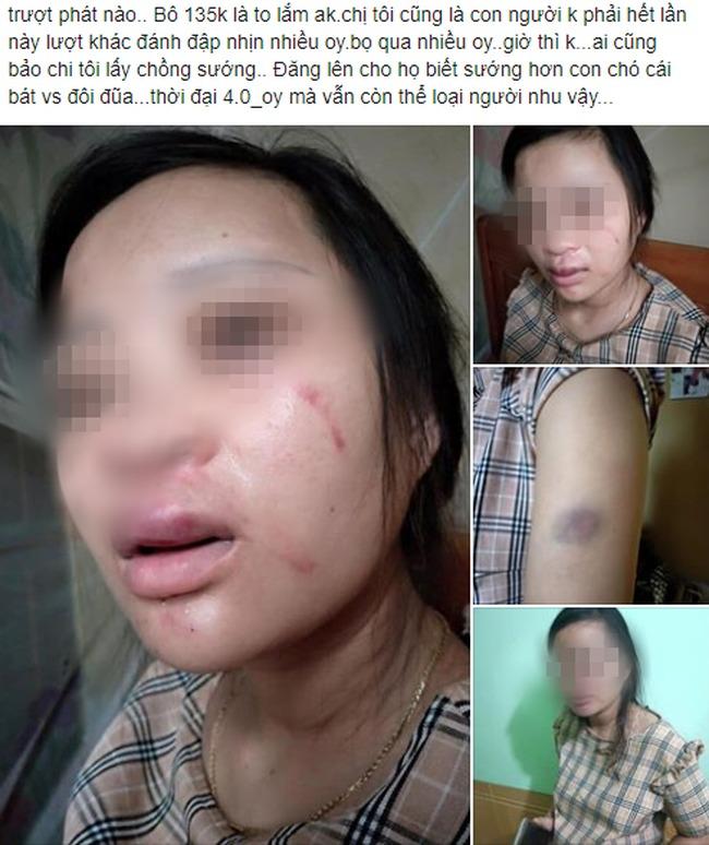 Vụ bà bầu mua giày 135k bị chồng đánh động thai, tiểu ra máu: Gia đình chồng thuộc diện khá giả-3