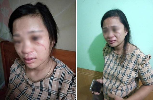 Vụ bà bầu mua giày 135k bị chồng đánh động thai, tiểu ra máu - 2sao