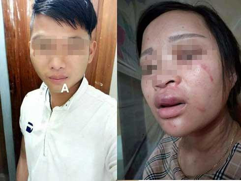 Vụ bà bầu 8 tháng mua giày 135k bị chồng đánh động thai: Người chồng nói 'Chỉ tát vợ 1 cái duy nhất và không phải chỉ vì chuyện mua đôi giày'