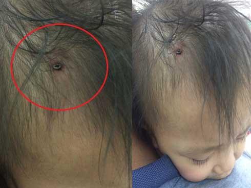 NÓNG: Bố nhờ người quen trông giúp con gái 6 tuổi, không ngờ con bị xâm hại tình dục tập thể ở Nghệ An?-7