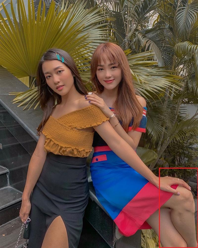 Đăng ảnh mừng sinh nhật Khả Ngân, Minh Hằng vô tình tự làm lộ khuyết điểm không thể phẫu thuật-1