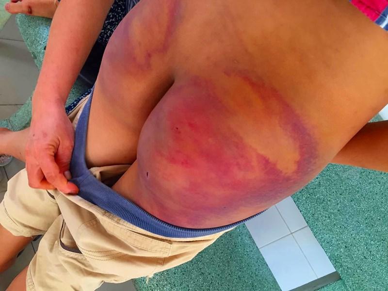 Bé trai 11 tuổi bị 1 người tu hành đánh dã man-2