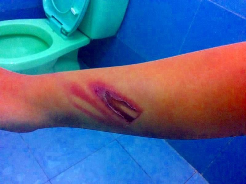 Bé trai 11 tuổi bị 1 người tu hành đánh dã man-3