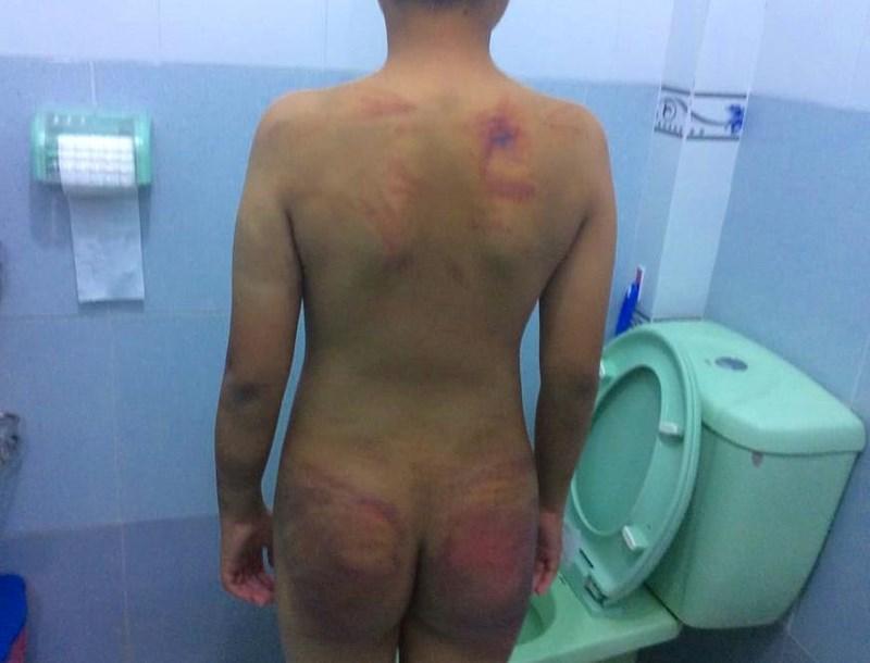 Bé trai 11 tuổi bị 1 người tu hành đánh dã man-4