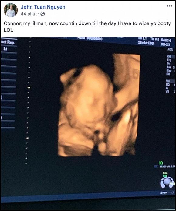 Mang thai tháng thứ 6, vợ chồng Lan Khuê bật mí giới tính và tên thân mật của con đầu lòng-1