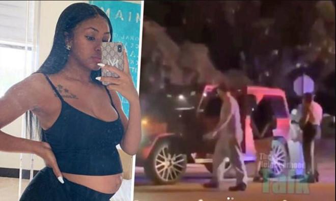 Nữ rapper Mỹ bị bắn 14 phát súng khi đang mang thai tháng thứ 6-1