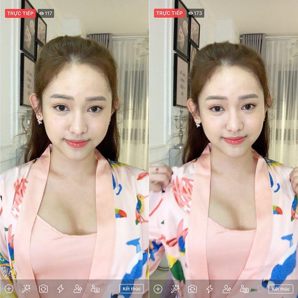 Thúy Vi lộ mặt cứng đơ, kém mịn màng khác xa ảnh tự sướng ảo tung chảo-4