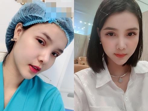 Kỳ Hân thú nhận 'nghiện' phẫu thuật thẩm mỹ, nhiều người vội can ngăn: 'Xin đừng làm thêm gì'