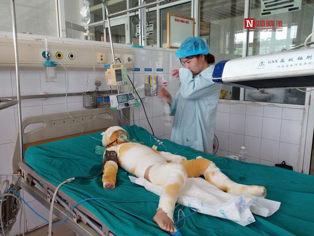 Vụ cô giáo đốt cồn dạy phòng chống cháy nổ: Nghẹn ngào lời kể của người mẹ trẻ-2