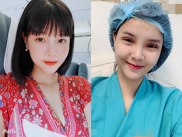 Bà xã Mạc Hồng Quân: Tôi dành dụm tiền sửa mũi, sửa răng để bớt bị chê quê mùa xấu xí-2