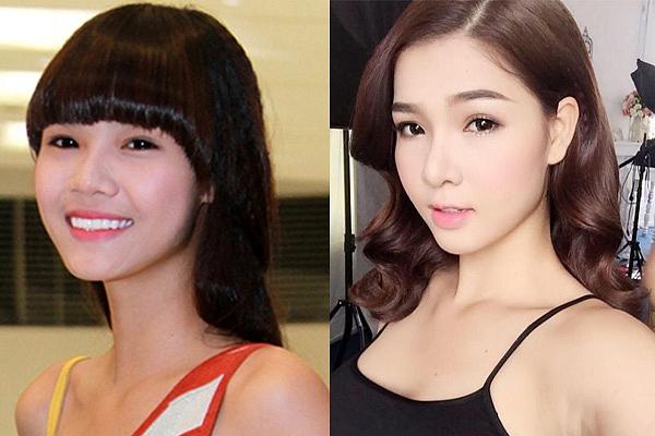 Bà xã Mạc Hồng Quân: Tôi dành dụm tiền sửa mũi, sửa răng để bớt bị chê quê mùa xấu xí-6