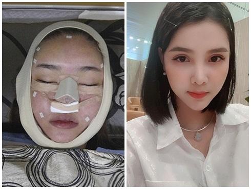 Bà xã Mạc Hồng Quân: 'Tôi dành dụm tiền sửa mũi, sửa răng để bớt bị chê quê mùa xấu xí'