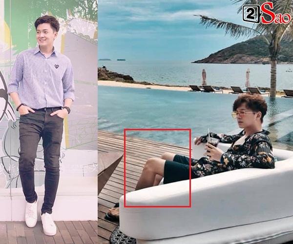 Tưởng giảm cân sẽ đẹp toàn diện, ai ngờ Ngô Kiến Huy lộ rõ chân que tăm nhìn đến thảm thương-9