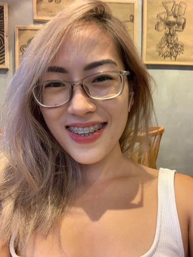 Đeo niềng răng nhưng vẫn đẹp nổi bật, gái xinh Hà thành tiết lộ hành trình 4 năm để có body đẹp từ trên xuống dưới-1