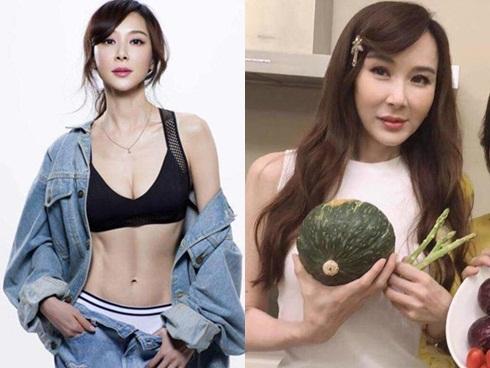 Katie Price xuất hiện với gương mặt biến dạng vì phẫu thuật thẩm mỹ-3