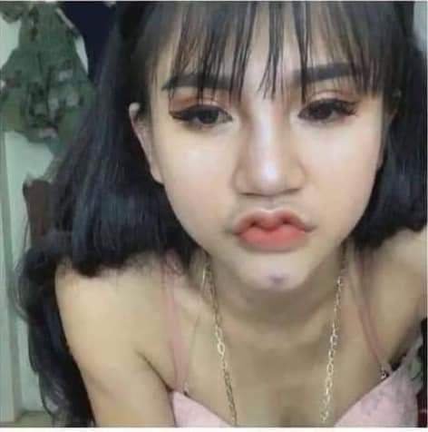 Ai bảo cứ môi trái tim là đẹp, cứ nhìn những ca thẩm mỹ này thì SÁNG MẮT NGAY-4