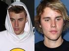 Justin Bieber và những lần bị chê lôi thôi, mặt đầy mụn