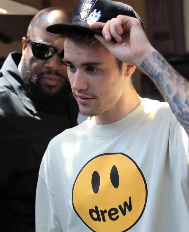 Justin Bieber và những lần bị chê lôi thôi, mặt đầy mụn-4