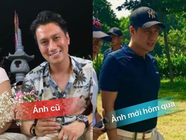 Ngó lơ lời chê bai nhan sắc, Việt Anh tiết lộ lý do thực sự khiến anh phải phẫu thuật trùng tu-5