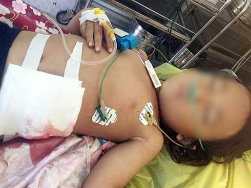 Ông nội tự lấy kim chỉ khâu vết thương của cháu gái bị máy cắt lòi ruột-1