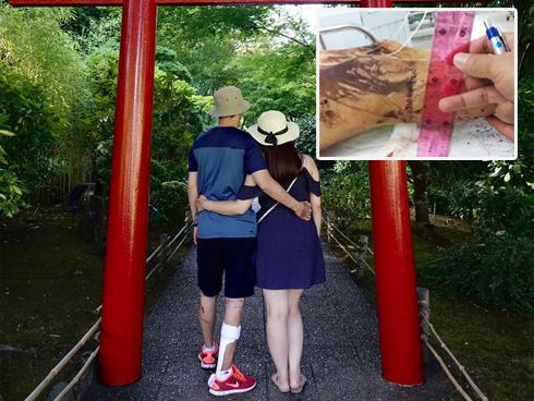 3 vụ tạt axit gây chấn động: Cô gái bị chồng sắp cưới hãm hại, đau nhất là người cuối cùng-4