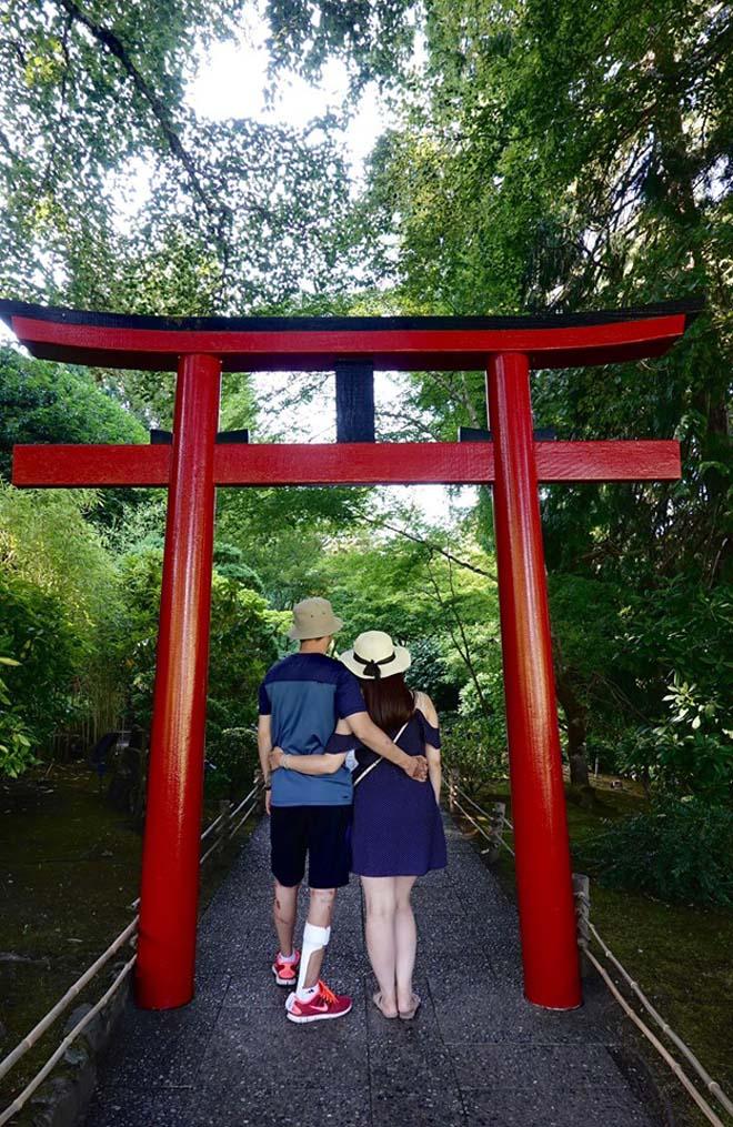 Việt kiều Canada bị cắt gân chân, tạt axit đến biến dạng khi chở bạn gái đi chơi giờ ra sao?-1