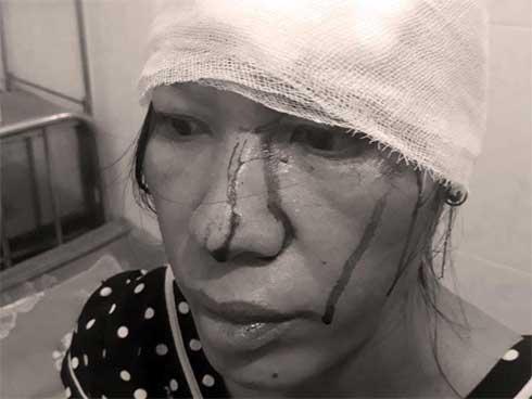 Người phụ nữ khuyết tật đang mang thai bị đánh nhập viện-1