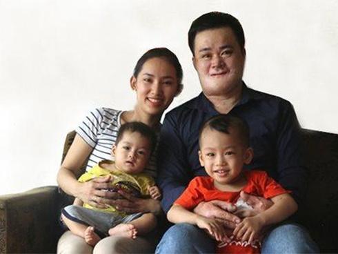 Quyết lấy chàng trai bị bỏng nặng 3 năm về trước, cô gái xinh đẹp có hạnh phúc viên mãn