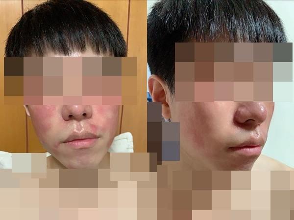 Anh chàng dị ứng tôm cố sống cố chết ăn cơm hộp do bạn gái làm và cái kết-1