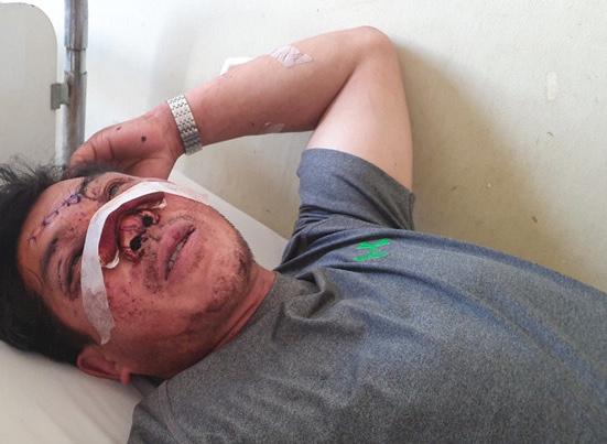 Giây phút cụ ông 91 tuổi văng khỏi xe thiệt mạng ở Khánh Hòa-2