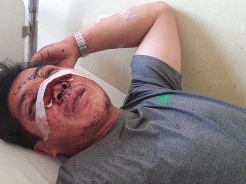 Giây phút cụ ông 91 tuổi văng khỏi xe thiệt mạng ở Khánh Hòa