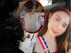 Vụ bé gái 6 tuổi nghi bị cưỡng hiếp tập thể ở Nghệ An: Công an khẳng định có dấu hiệu dàn dựng