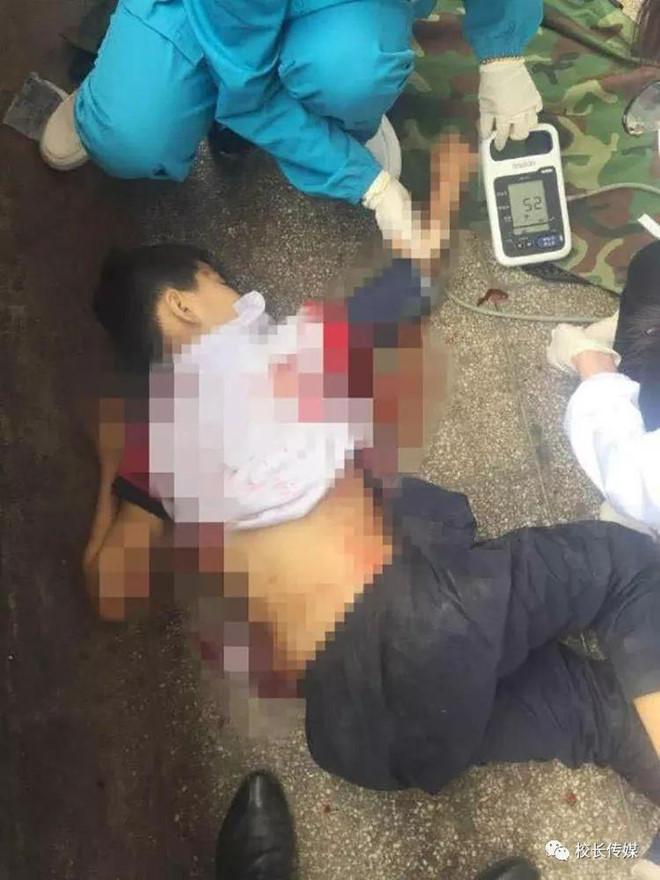 Bé trai bị bố bạn cùng lớp sát hại vì tội bắt nạt-2