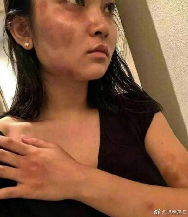 3 mỹ nam trên phim là soái ca ngôn tình, ngoài đời lại thẳng tay đánh bạn gái trối chết-2