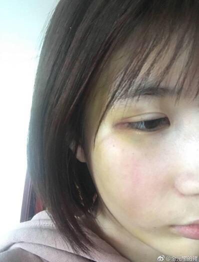 3 mỹ nam trên phim là soái ca ngôn tình, ngoài đời lại thẳng tay đánh bạn gái trối chết-6