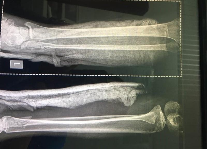 Công an lý giải vì sao chưa bắt khẩn cấp kẻ đánh vợ dã man-4