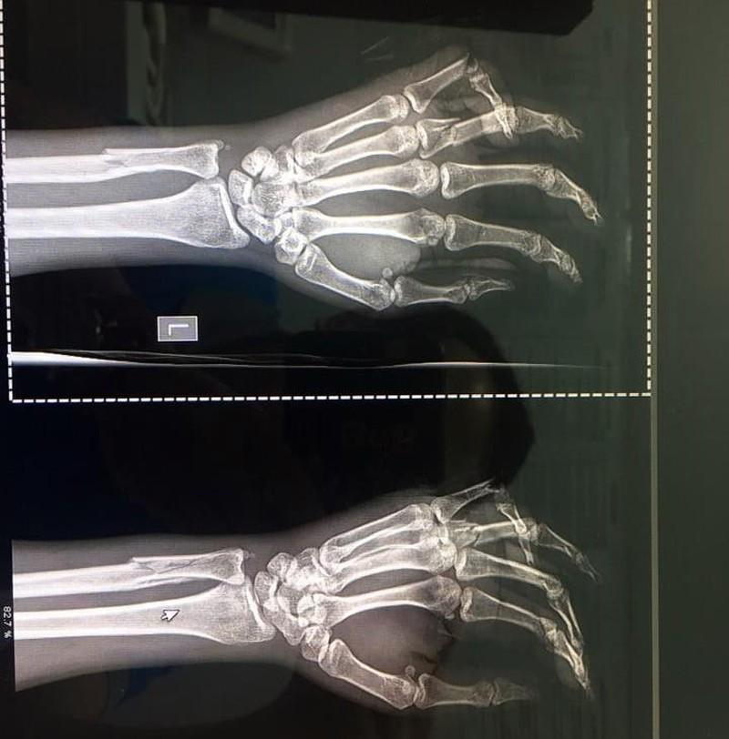 Công an lý giải vì sao chưa bắt khẩn cấp kẻ đánh vợ dã man-5