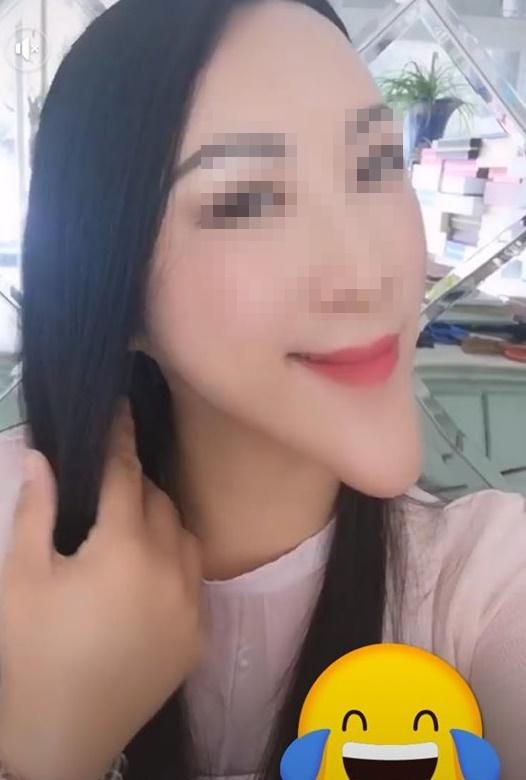 Gái xinh xuất hiện với chiếc cằm dài ngoằng, dân tình đoán già đoán non chắc do dao kéo quá đà đây mà-1