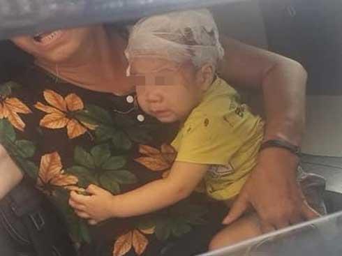 Chổi lau nhà rơi từ tầng 17 trúng đầu bé trai 1 tuổi-1